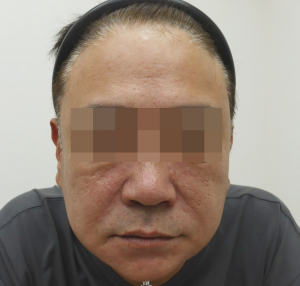 After